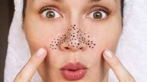 1646473381_622330a48b5ac