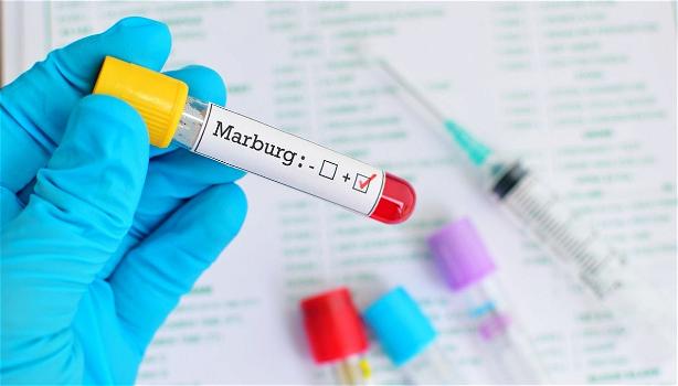Marburg, “Virus altamente letale e contagioso”: rischio epidemia dopo i primi casi