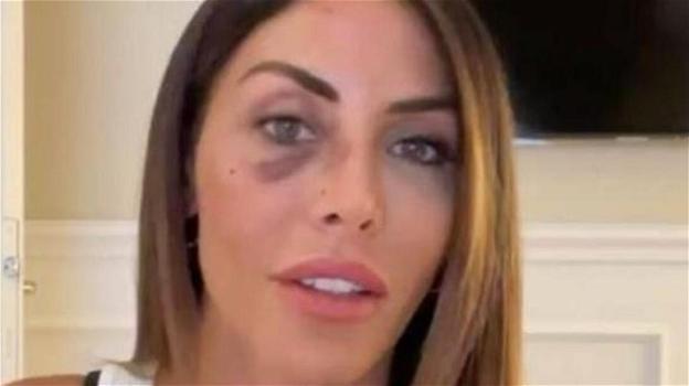 "Mi ha inseguito e preso a bastonate con una mazza da baseball": la showgirl italiana denuncia tutto