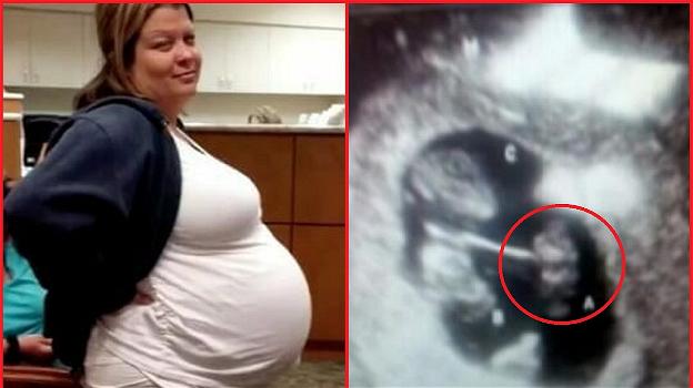 Rimane incinta per la prima volta, quando i medici vedono l’ecografia si spaventano