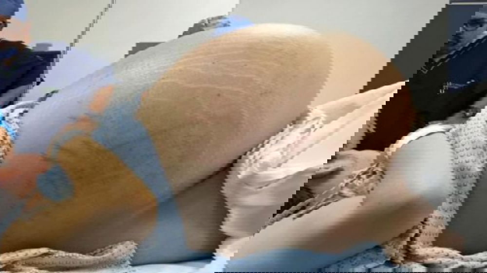 Va in ospedale con una pancia enorme, poi si scopre la tremenda verità