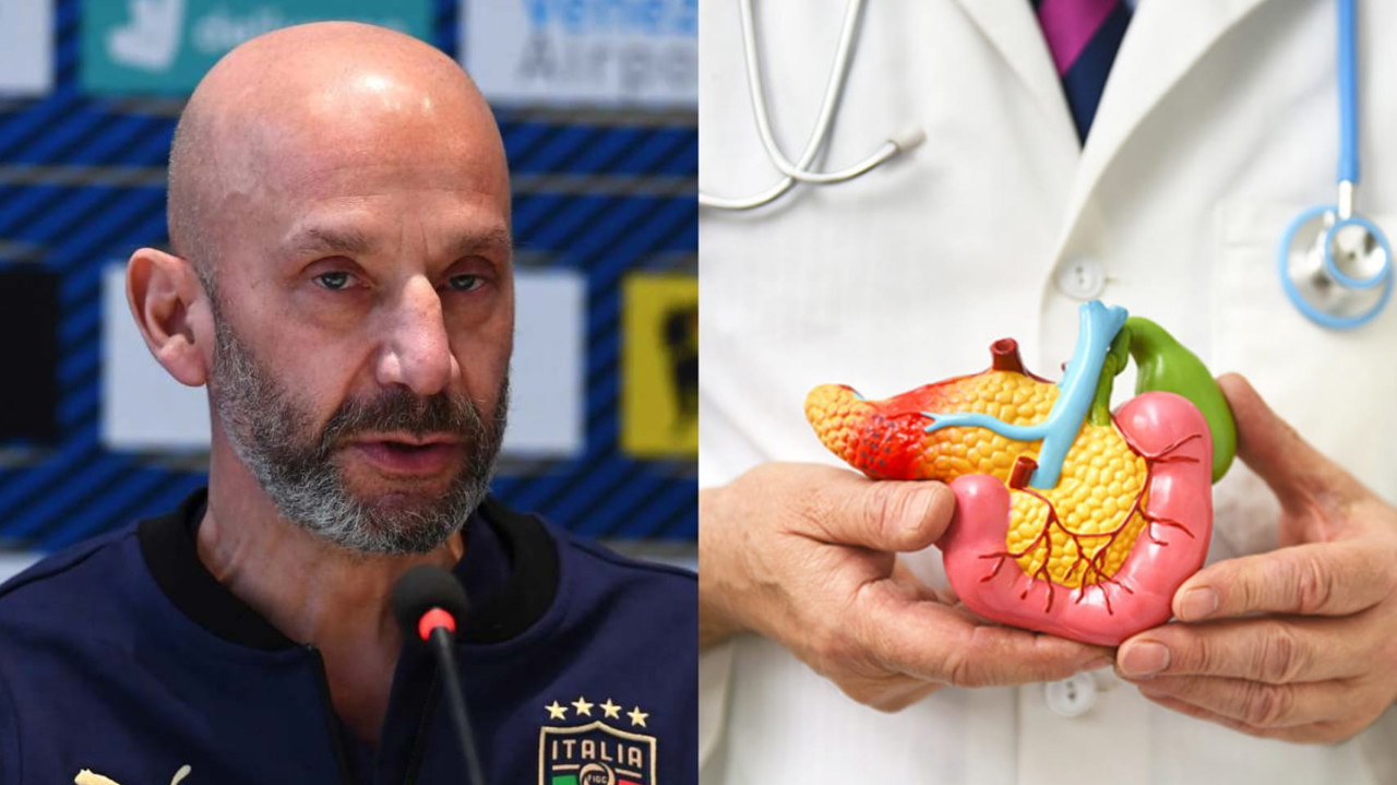 Tumore del pancreas, si può sopravvivere? Le parole del medico Tumore del pancreas, si può sopravvivere? Le parole del medico