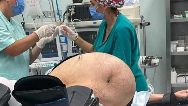 Fate attenzione, si rischia la vita: non mangiatene troppe