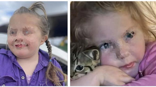 Bimba muore soffocata a 5 anni con una merendina