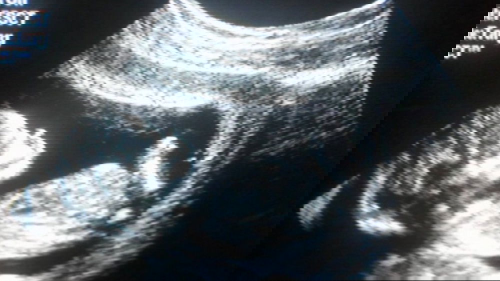 I medici sono choccati: la Vip è incinta, ma qualcosa non torna