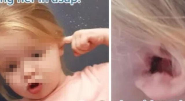 Orecchio arrossato e prurito, la scoperta choc sulla bambina di 2 anni