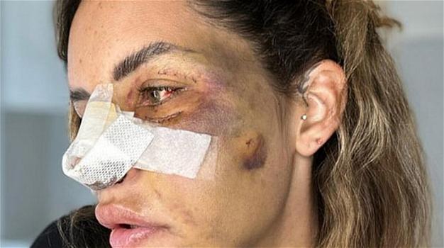 “Ridotta così”: l’amata vip italiana mostra il suo volto dopo l’incidente