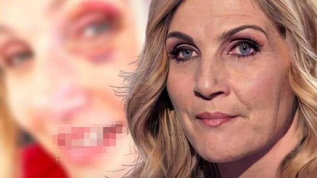 Lorella Cuccarini, l’accusa sui social: "Mi ha ridotta così.."