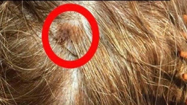 La parrucchiera nota una strana cosa sui capelli: dalla foto emerge la verità