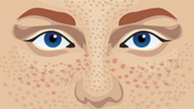 La chiamano la malattia del sole, 5 regole da seguire per proteggersi