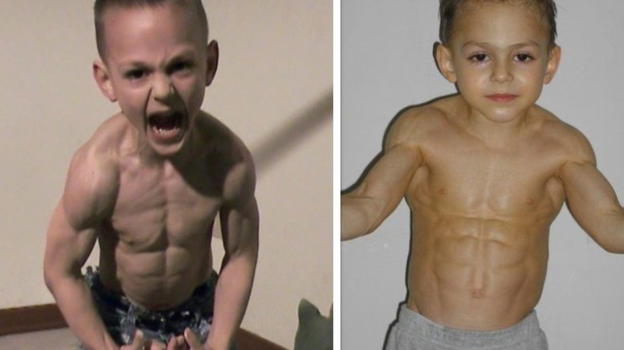 Giuliano, il bimbo più forte del mondo: eccolo oggi 15 anni dopo