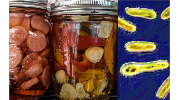 Attenzione, scoperto botulino nel cibo: ci sono decessi
