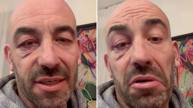 Matteo Bassetti choc, si presenta così in diretta Tv: "Colpa di.."