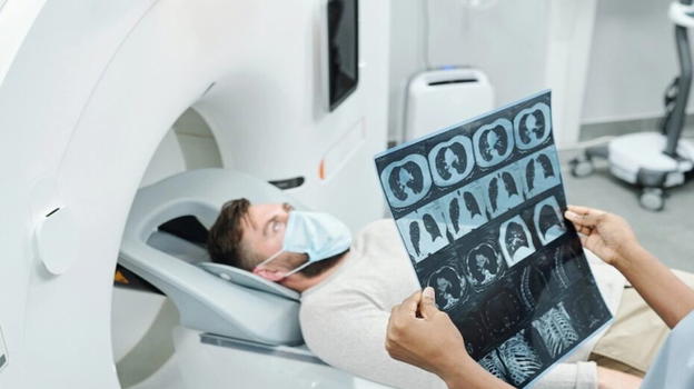 Neoplasie, boom di casi per chi ha questa età. Gli esperti: "Ecco cosa li causa"