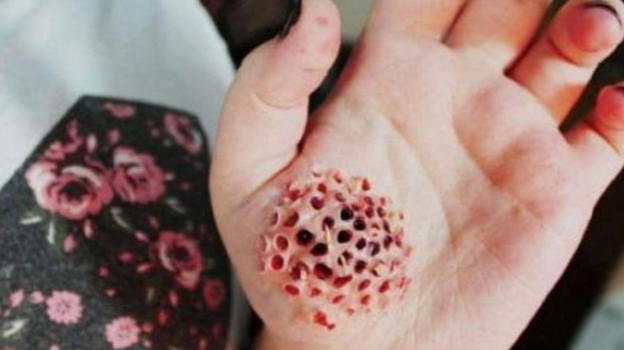 Attenzione a questo sintomo, indica la presenza di..