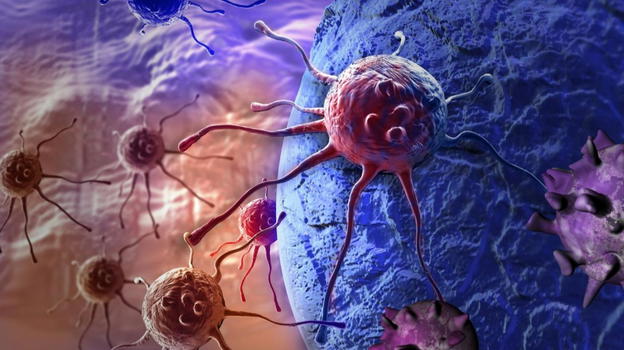 Neoplasia, attenzione a questi sintomi: i campanelli di allarme