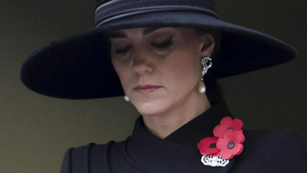 Kate Middleton, Caprarica: "Neoplasia a uno stadio più avanzato"