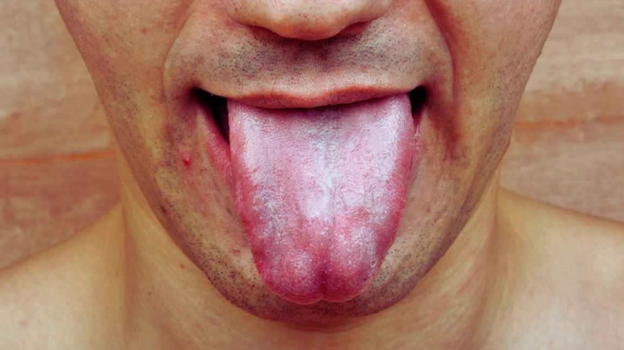 Salute, inizia tutto dalla lingua: il monito degli esperti