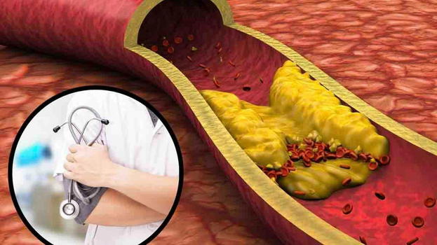 Salute, i consigli dei medici: ecco cosa bere per tenere a bada il colesterolo