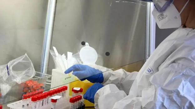 Allarme ragno violino in Italia: ecco dove si nasconde e come riconoscerlo