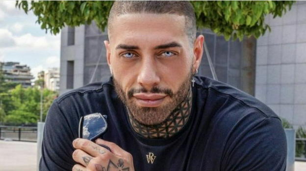 Francesco Chiofalo: "Dopo occhi, naso, labbra e orecchie mi rifarò il..