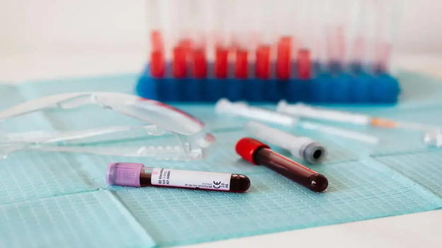Infarto, la nuova straordinaria tecnica che lo scopre in pochi minuti