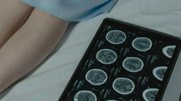 Neoplasia del Marinaio, che cos’è e perché colpisce la pelle