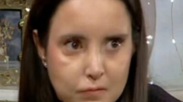 "Orgoglioso di te". La figlia di Mancini racconta della sua malformazione