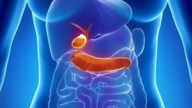 Neoplasia alla cistifellea in aumento tra i giovani: l’allarme degli esperti