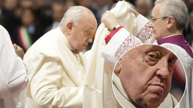 Una preghiera per il nostro caro Papa Francesco: cos’ha sotto il mento
