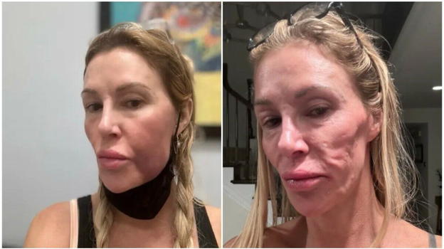 L’attrice Brandi è irriconoscibile, ecco cosa è successo al mio volto