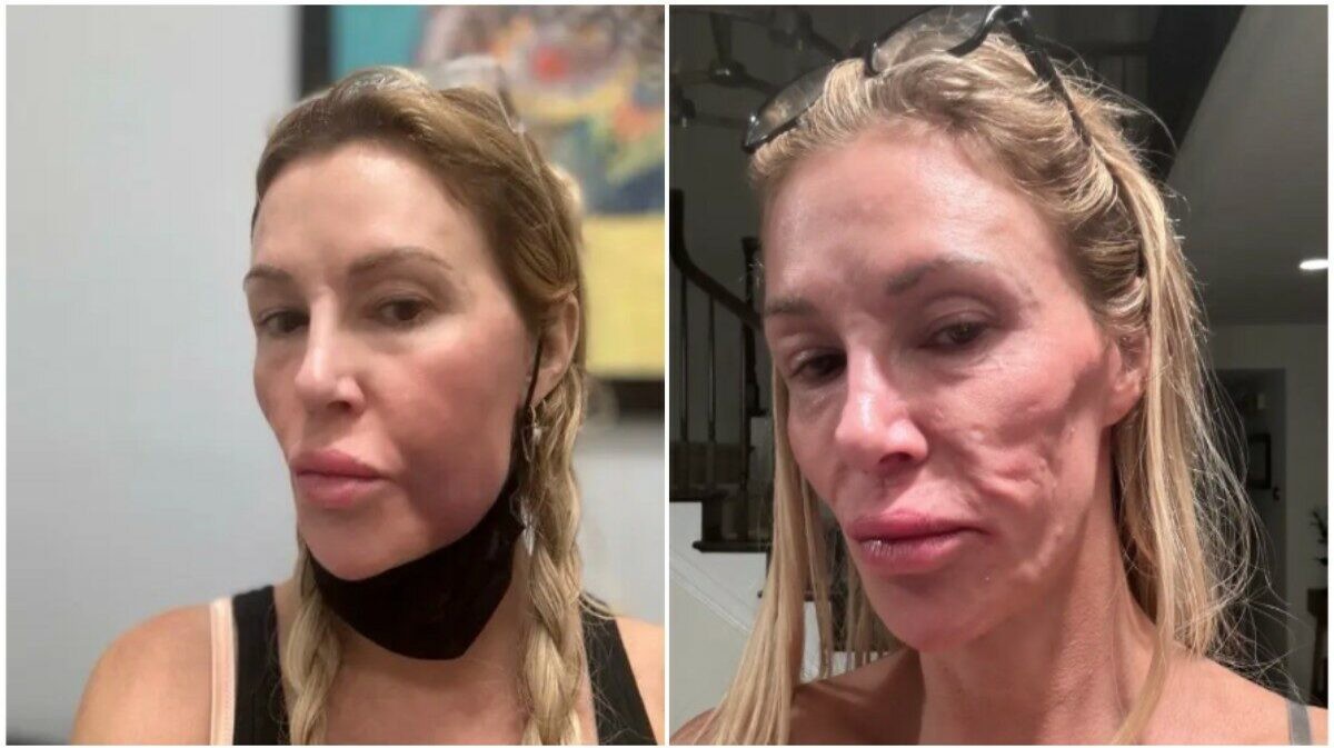 La trasformazione shock di Brandi: cosa è successo al suo volto?