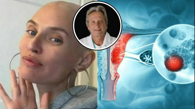 Neoplasia alle ovaie, parla l’oncologo: "Ecco l’errore da evitare assolutamente"