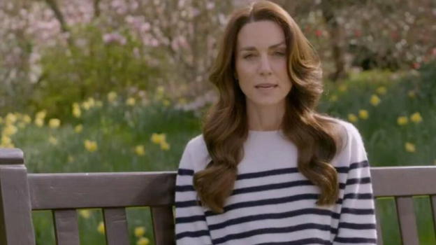 Kate Middleton, nuovo segreto per la Principessa: operata alla testa