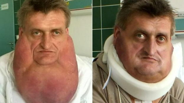 Si presenta così in ospedale, l’uomo interrogato dice di aver..