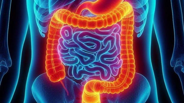 Neoplasia dell’intestino, il sintomo che ti deve allarmare