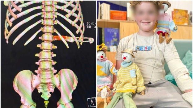 "Sotto gli occhi della madre" il dramma del bimbo di 10 anni che gioca vicino alla lavastoviglie