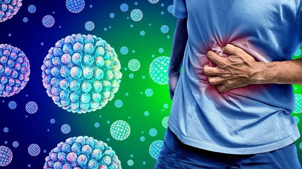 Norovirus, l’annuncio di Matteo Bassetti: ecco a cosa fare attenzione