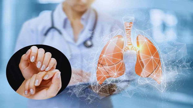 Polmoni, test da 5 secondi da fare sulle unghie fa scoprire grave patologia