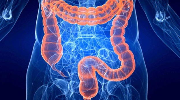 L’alimento che riduce il rischio di neoplasia al colon