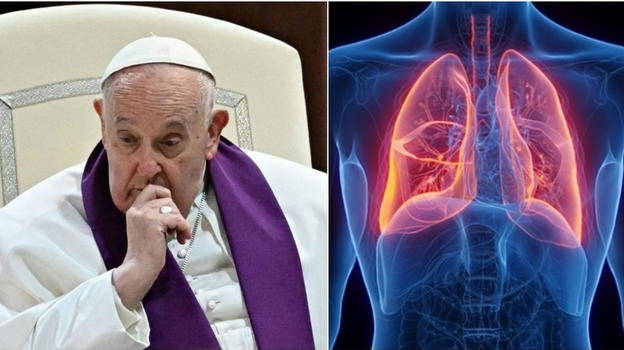 Papa Francesco, i dubbi di Matteo Bassetti: "Ormai..