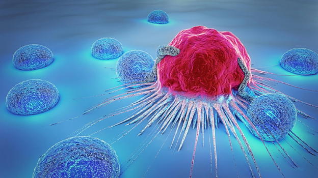 L’allarme dei medici, ecco qual è la neoplasia più frequente in Italia