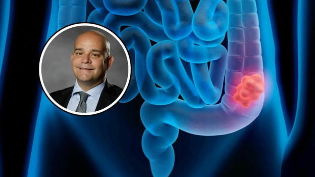 Neoplasia al colon in aumento, il monito dell’oncologo: "Ecco quali sono i sintomi sottovalutati"