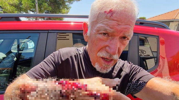 Sebastiano Visintin, la foto fa il giro del web: cosa è successo