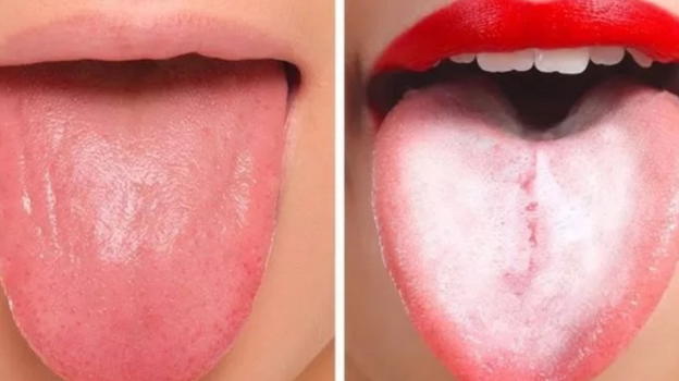 Il dottor Cugini avvisa: "La lingua primo segnale che nel nostro corpo c’è qualcosa che non va..