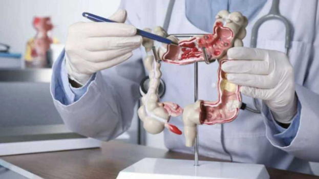 Patologie al colon, la scoperta choc degli scienziati cambia tutto