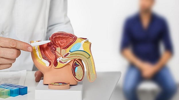Neoplasia alla prostata, la straordinaria scoperta che può salvarti la vita