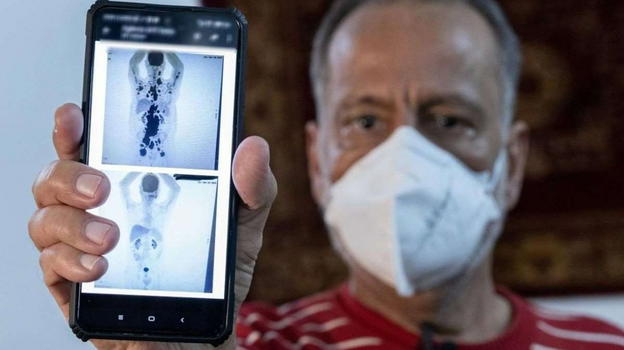 Malato terminale guarisce dopo una cura di soli 30 giorni