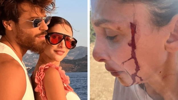 Can Yaman, la fidanzata Sara denuncia le violenze dell’ex. L’attore risponde: "Io ti amo"