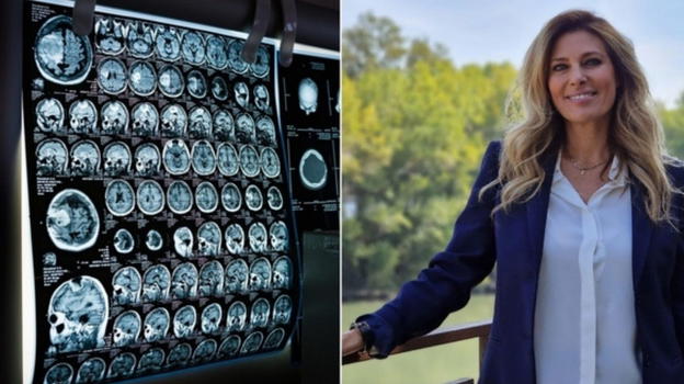 Decesso di Claudia Adamo, l’oncologo spiega la patologia: "Inizia tutto con…"